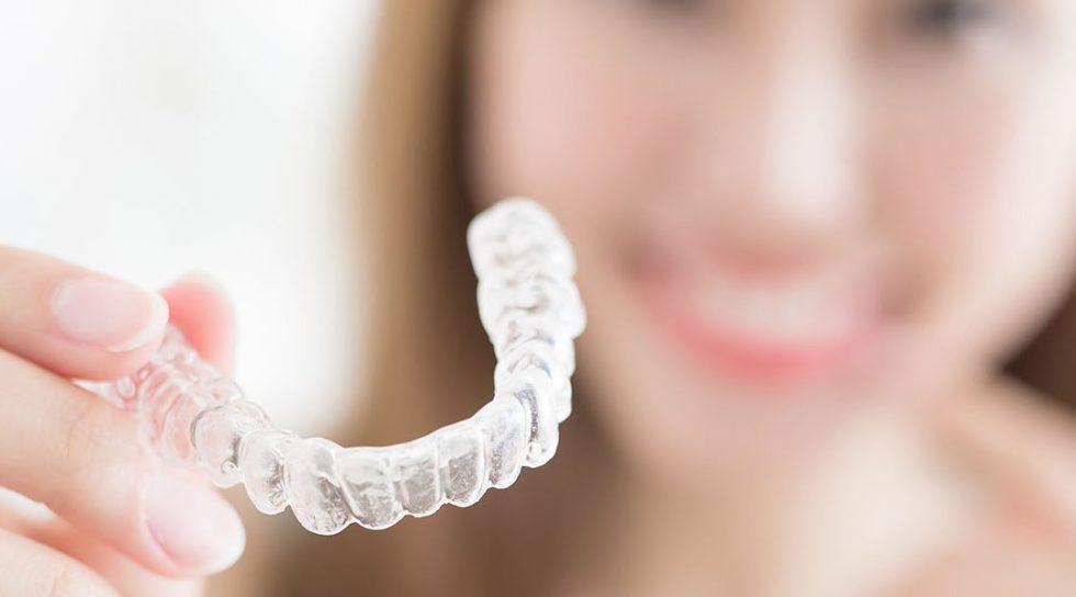 Limpiar Invisalign de Tabaco: Consejos Efectivos