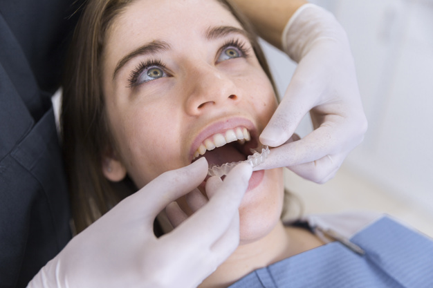 ¿Brackets o invisalign? Diferencias entre ortodoncias