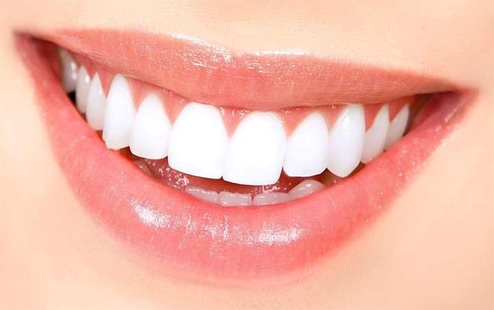 Una boca sana sin dientes amarillos